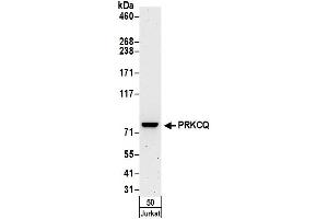 Western Blotting (WB) image for anti-Protein Kinase C, theta (PRKCQ) (AA 350-400) antibody (ABIN7450604)