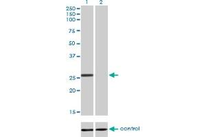 Western blot analysis of BCAS2 over-expressed 293 cell line, cotransfected with BCAS2 Validated Chimera RNAi (Lane 2) or non-transfected control (Lane 1). (BCAS2 Antikörper  (AA 116-225))
