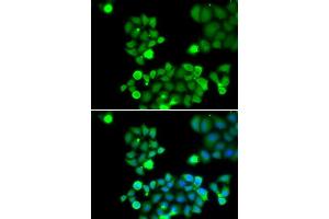 Immunofluorescence analysis of HeLa cells using NEIL1 antibody (ABIN5973442). (NEIL1 Antikörper)