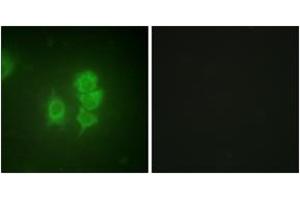 Immunofluorescence analysis of HuvEc cells, using MSK1 (Ab-581) Antibody.