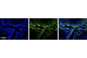 Rabbit Anti-PLOD2 Antibody     Formalin Fixed Paraffin Embedded Tissue: Human Bronchial Epithelial Tissue  Observed Staining: Cytoplasmic  Primary Antibody Concentration: 1:100  Secondary Antibody: Donkey anti-Rabbit-Cy3  Secondary Antibody Concentration: 1:200  Magnification: 20X  Exposure Time: 0. (PLOD2 Antikörper  (Middle Region))