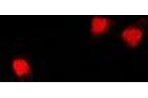 Immunofluorescent analysis of U2AF65 staining in U2OS cells. (U2AF2 Antikörper)