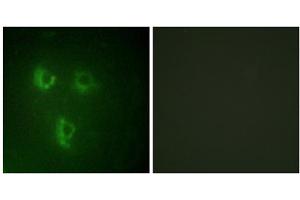 Immunofluorescence analysis of HUVEC cells, using TMEPA antibody. (PMEPA1 Antikörper  (Internal Region))