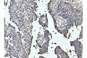 IHC analysis of RRP4/EXOSC2 using anti-RRP4/EXOSC2 antibody (ABIN7602188). (EXOSC2 Antikörper  (AA 62-293))