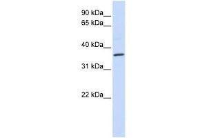 CCR5 antibody used at 5 ug/ml to detect target protein. (CCR5 Antikörper  (Middle Region))