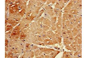 Immunohistochemistry of paraffin-embedded human heart tissue using ABIN7145367 at dilution of 1:100 (B3GALT2 Antikörper  (AA 201-422))