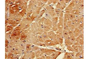 Immunohistochemistry of paraffin-embedded human heart tissue using ABIN7145367 at dilution of 1:100
