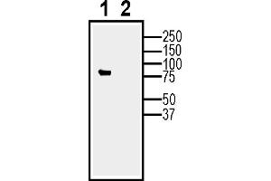 Expression of Calnexin in  cells (lane 1) and in -derived exosomes (lane 2). (Calnexin (CANX) Peptid)