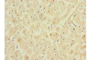 Immunohistochemistry of paraffin-embedded human heart tissue using ABIN7159469 at dilution of 1:100