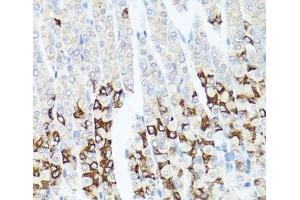 Immunohistochemistry of paraffin-embedded Mouse stomach using GPM6A Polyclonal Antibody at dilution of 1:100 (40x lens). (GPM6A Antikörper)