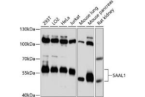 SAAL1 Antikörper  (AA 175-474)