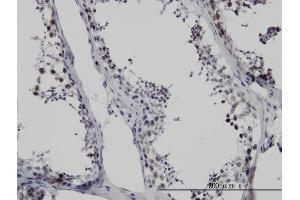 Immunoperoxidase of monoclonal antibody to SMNDC1 on formalin-fixed paraffin-embedded human testis. (SMNDC1 Antikörper  (AA 1-238))