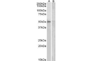 ABIN184642 (2µg/ml) staining of Human Bone Marrow (A) and PBL (B) lysates (35µg protein in RIPA buffer). (DOK3 Antikörper  (C-Term))