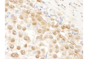 Immunohistochemistry (IHC) image for anti-N(alpha)-Acetyltransferase 15, NatA Auxiliary Subunit (NAA15) (AA 816-866) antibody (ABIN7448680) (NAA15 Antikörper  (AA 816-866))
