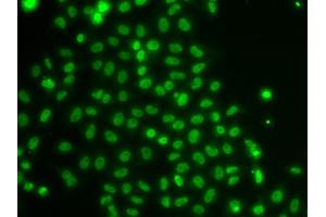 Immunofluorescence analysis of U2OS cells using TOX antibody.