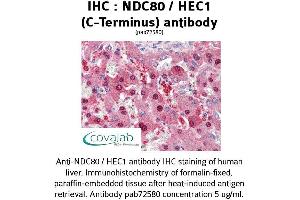 Image no. 2 for anti-NDC80 Kinetochore Complex Component Homolog (NDC80) (C-Term) antibody (ABIN1737233) (NDC80 Antikörper  (C-Term))