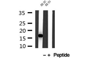 Western blot analysis of extracts of HEK-293 cells, using IFT20 antibody. (IFT20 Antikörper)