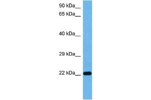 Host:  Mouse  Target Name:  TNNI3  Sample Tissue:  Mouse Pancreas  Antibody Dilution:  1ug/ml (TNNI3 Antikörper  (Middle Region))