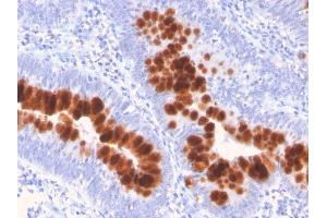 Immunohistochemistry (IHC) image for anti-TNF Receptor Superfamily, Member 6 (FAS) (AA 26-96) antibody (ABIN6939781)