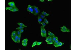 Immunofluorescent analysis of HepG2 cells using ABIN7144899 at dilution of 1:100 and Alexa Fluor 488-congugated AffiniPure Goat Anti-Rabbit IgG(H+L)
