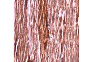 Akt2 antibody immunohistochemistry analysis in formalin fixed and paraffin embedded mouse skeletal muscle. (AKT2 Antikörper  (AA 93-122))