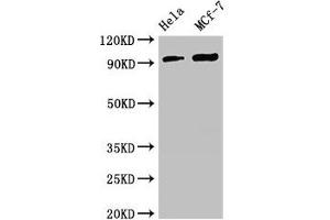 Western Blot Positive WB detected in: Hela whole cell lysate, MCF-7 whole cell lysate All lanes: TTC27 antibody at 2. (TTC27 Antikörper  (AA 590-817))