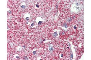 anti-Shroom Family Member 2 (SHROOM2) (AA 1554-1616) antibody