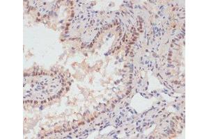 Immunohistochemistry of paraffin-embedded Rat lung using Phospho-PEA15(S104) Polyclonal Antibody at dilution of 1:100 (40x lens). (PEA15 Antikörper  (pSer104))