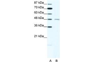 WB Suggested Anti-CHRND Antibody   Titration: 2.