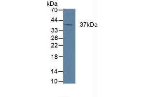 Detection of CTSK in Porcine Heart Tissue using Polyclonal Antibody to Cathepsin K (CTSK) (Cathepsin K Antikörper  (AA 54-317))