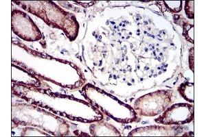 Immunohistochemical analysis of paraffin-embedded human kidney tissues using CDH16 mouse mAb with DAB staining.