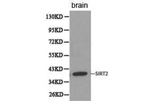 Western Blotting (WB) image for anti-Sirtuin 2 (SIRT2) antibody (ABIN1874785) (SIRT2 Antikörper)
