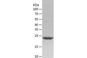 Western Blotting (WB) image for RAB27B, Member RAS Oncogene Family (RAB27B) (AA 1-218) protein (His tag) (ABIN7124746) (RAB27B Protein (AA 1-218) (His tag))