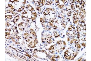 Immunohistochemistry of paraffin-embedded rat heart using β-actin antibody. (beta Actin Antikörper)