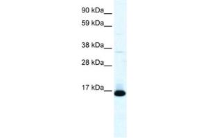 Western Blotting (WB) image for anti-Transcription Factor 21 (TCF21) antibody (ABIN2460724)
