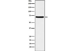 Western Blotting (WB) image for anti-Chromatin Assembly Factor 1, Subunit B (p60) (CHAF1B) antibody (ABIN7607016)