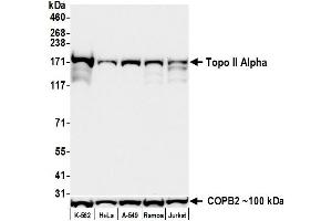 Western Blotting (WB) image for anti-Topo IIalpha (AA 650-700) antibody (ABIN7795794)