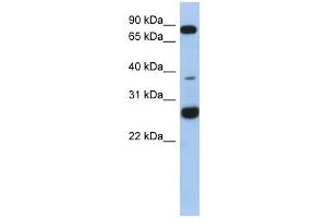 C1ORF110 antibody used at 1 ug/ml to detect target protein. (C1ORF110 Antikörper  (N-Term))