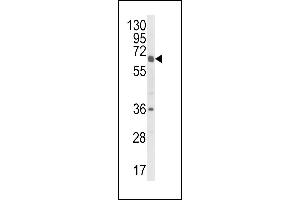 CYP2C18 Antikörper  (C-Term)