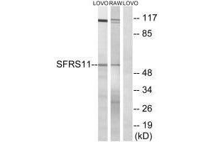 Western blot analysis of extracts from LOVO cells and RAW264. (SRSF11 Antikörper)