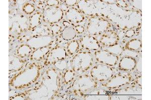 Image no. 1 for anti-Nuclear Receptor Coactivator 4 (NCOA4) (AA 505-615) antibody (ABIN599026) (NCOA4 Antikörper  (AA 505-615))