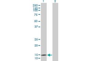 Western Blot analysis of SYNJ2BP expression in transfected 293T cell line by SYNJ2BP MaxPab polyclonal antibody. (SYNJ2BP Antikörper  (AA 1-145))