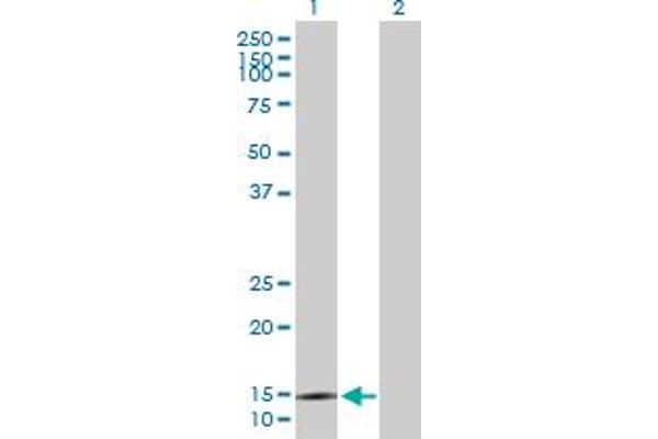 SYNJ2BP Antikörper  (AA 1-145)