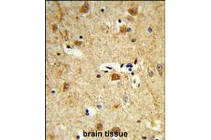 Formalin-fixed and paraffin-embedded human brain tissue reacted with DOLK Antibody , which was peroxidase-conjugated to the secondary antibody, followed by DAB staining. (Dolichol Kinase Antikörper  (AA 312-339))