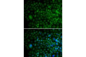 Immunofluorescence analysis of U20S cell using ANG antibody. (ANG Antikörper)