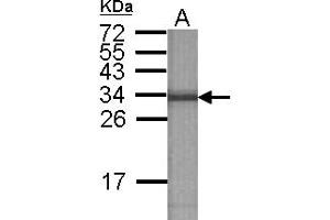 Image no. 2 for anti-ATPase, H+ Transporting, Lysosomal 31kDa, V1 Subunit E2 (ATP6V1E2) antibody (ABIN1502161) (ATP6V1E2 Antikörper)