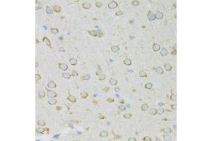 Immunohistochemistry of paraffin-embedded rat brain using RPL13 antibody (ABIN1682571, ABIN5664631, ABIN5664633 and ABIN6220492) at dilution of 1:100 (40x lens). (RPL13 Antikörper  (AA 1-211))
