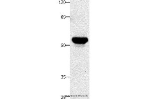 Western blot analysis of Human fetal brain tissue, using TNFRSF21 Polyclonal Antibody at dilution of 1:420 (TNFRSF21 Antikörper)