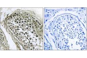 Immunohistochemistry analysis of paraffin-embedded human tesophagusis, using GAB4 Antibody. (GAB4 Antikörper  (AA 21-70))