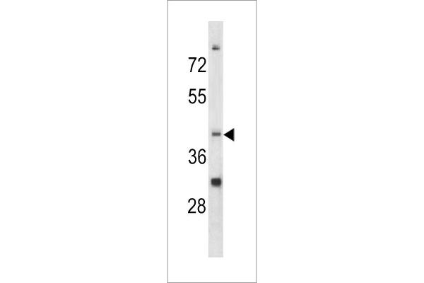 CCRN4L Antikörper  (C-Term)